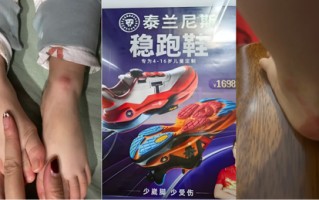 千元童鞋把脚穿肿？泰兰尼斯遭家长“围攻”，医生警惕影响发育，90%专利竟是外观设计