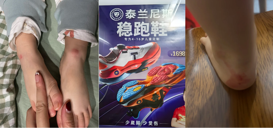 千元童鞋把脚穿肿？泰兰尼斯遭家长“围攻”，医生警惕影响发育，90%专利竟是外观设计  第1张
